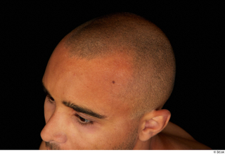 Aaron bald hair 0002.jpg